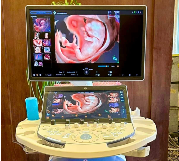 Máy Siêu Âm 4D Cao Cấp RAD-X200